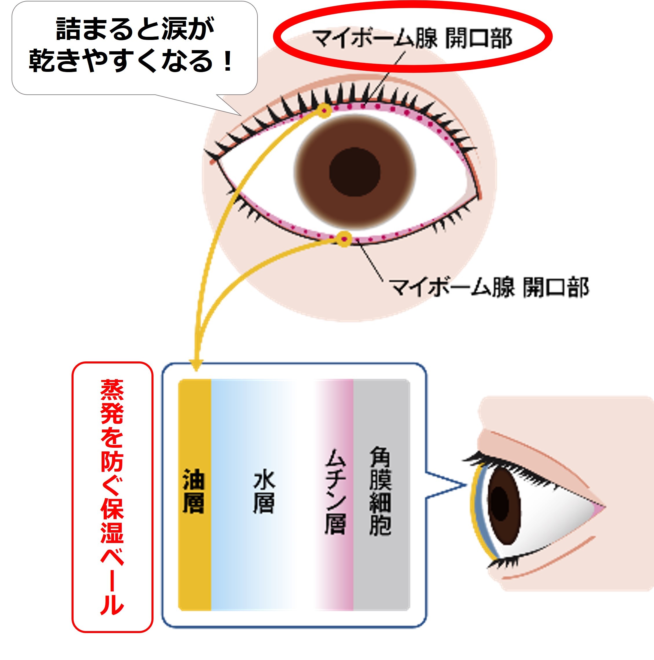 ӊOƒmȂIH̃ACCNŋC|Cg@傫郁CNA̓hCAC[Ă\@ڂɗDACCNƃPA@g̕ێx[h𗐂Ƌɉ