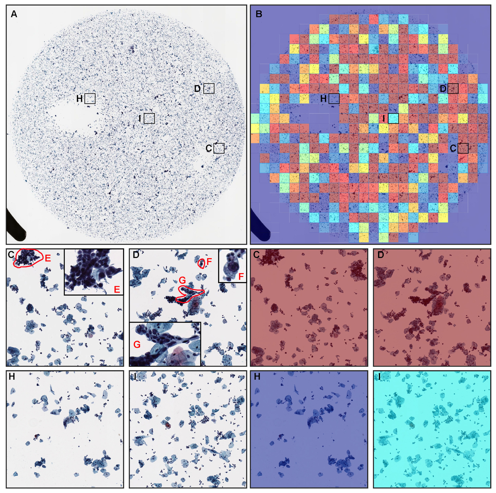 q{򂪂񌟐fxɐvaAI̊Jɐ@` Cancersɘ_f(Cancers/WFArtificial Intelligence in Oncology) `