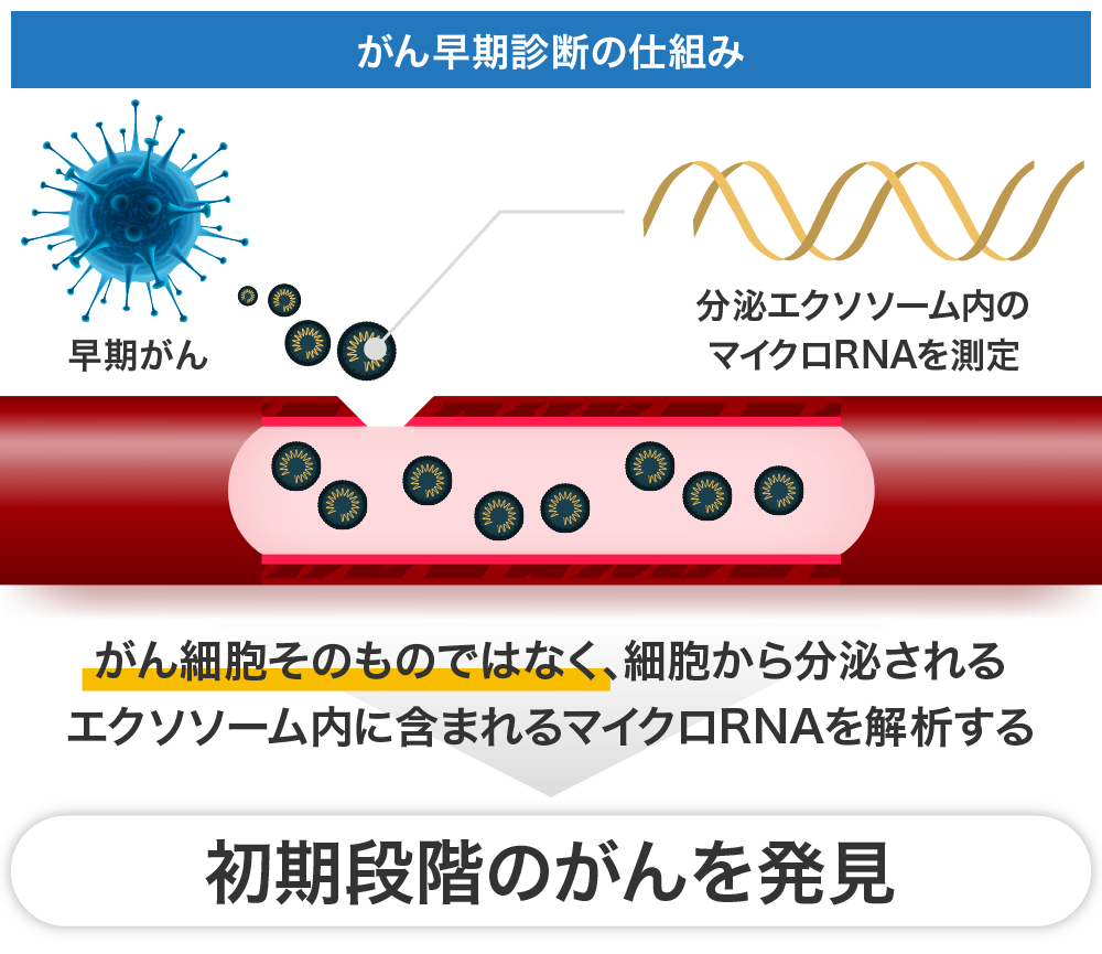 2023N111(f[)ACk̂񔭌VXewLbhoCIvV[xƉ{iX^[gI