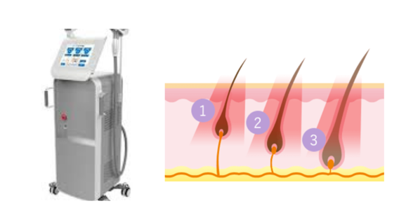 r[NjbN{@ EуTuJ[vÒEѐNjbNuWFj[NjbNv̌lEы~ϊX^[g@https://beclinic.jp/topics/ginza/