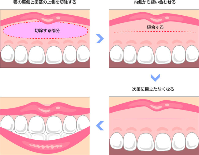 Well-Being DENTAL CLINICiEFr[COf^NjbNj2023N415`514 PeatixɂāAPHIJAbvf[g~[eBO2023u~evɓodB