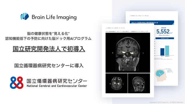 yJ@lŏz]̌NԂg鉻hBFm@\ቺ̗\hɌ]hbNpAIvOuBrain Life Imaging(R)vzaZ^[œ