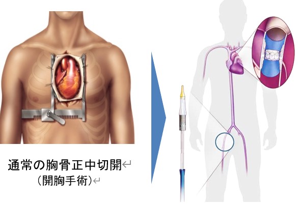 {̌oJe[exَÁi@\sSɊׂ̕ق̒ujAGh[Y̌oJe[e̕قAVS̊҂̊Jp񐔂炷\ɍv