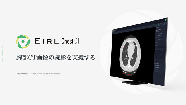CT摜̓ǉexEIRL Chest CT̔̔Jn